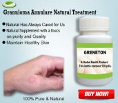 Granuloma Annulare Natural Treatment